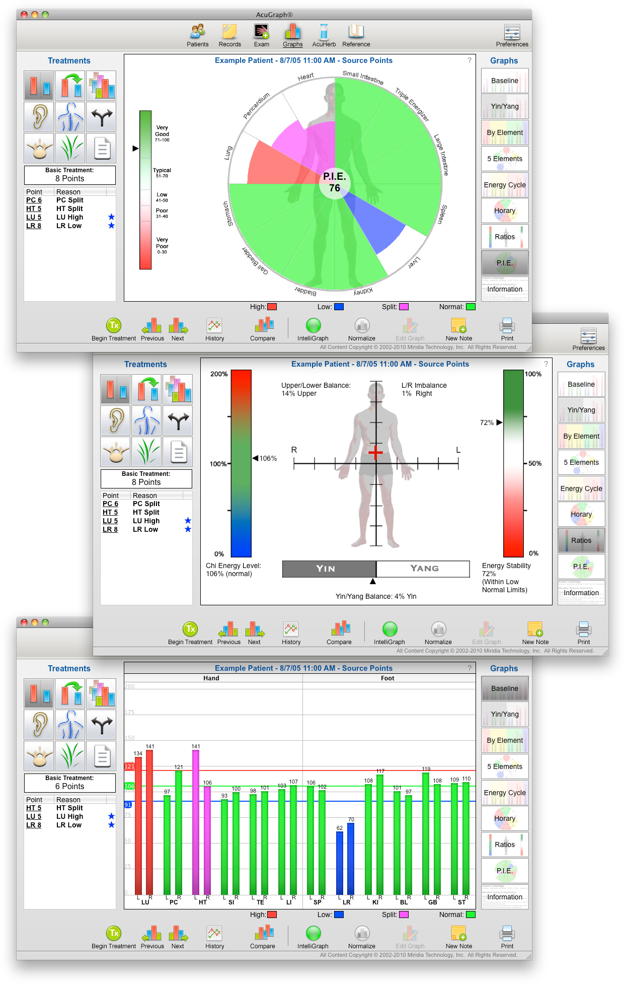 Acugraph Exam Findings